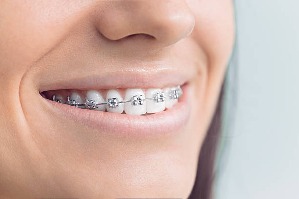 Why Choose Us for Your Dental Needs in Absecon, NJ